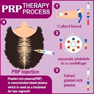 prp therapy process