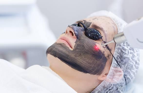 carbon laser facial consultation 