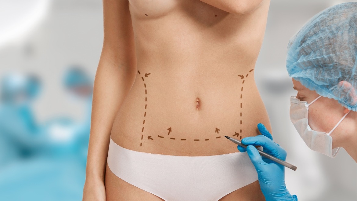 rhinoplasty consultation